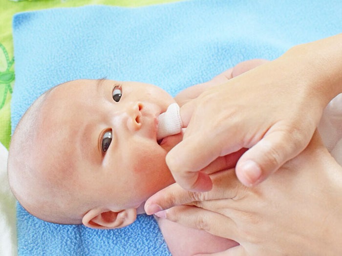 Nanh sữa ở trẻ sơ sinh là gì? Dấu hiệu nhận biết và cách xử lý Vệ sinh răng miệng cho trẻ sơ sinh không đúng cách tăng khả năng bị nang lợi