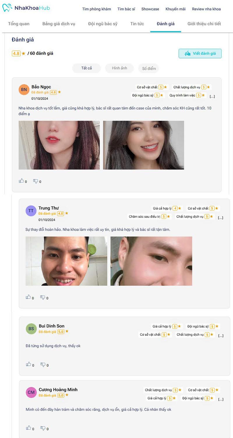 Cẩm nang nha khoa ở Nguyễn Du: Dịch vụ, chi phí, đánh giá Hình ảnh khách hàng trước và sau khi sử dụng dịch vụ