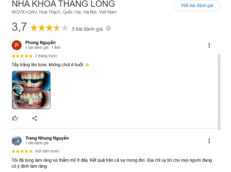 Top các nha khoa ở Quốc Oai uy tín và chất lượng Đánh giá của khách hàng