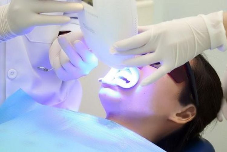 Toàn Tâm cung cấp dịch vụ tẩy trắng răng hiện đại