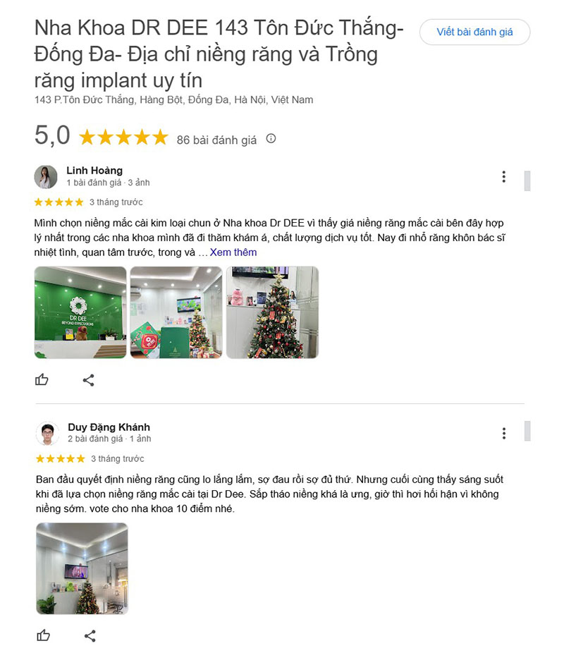 Dịch vụ niềng răng nhận được nhiều nhận xét tích cực từ người sử dụng trước đó 