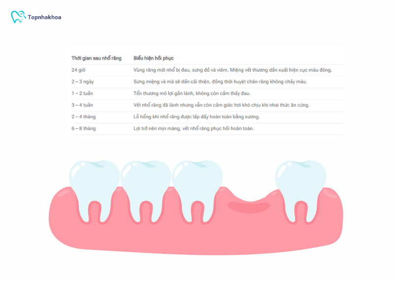 Tùy vào cơ địa mỗi người mà thời gian hồi phục sau nhổ răng sẽ khác nhau