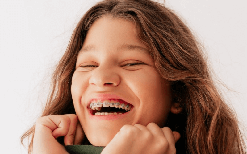 Niềng răng có được vĩnh viễn không phụ thuộc vào tình trạng răng, cách đeo hàm duy trì,...