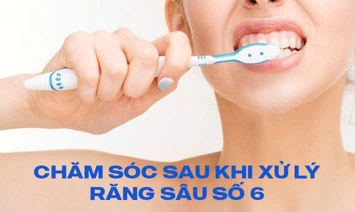Răng số 6 bị sâu vỡ có sao không? Cách xử lý nhanh, an toàn Sau khi thực hiện điều trị răng số 6 bị sâu, việc chăm sóc và bảo vệ răng là rất cần thiết