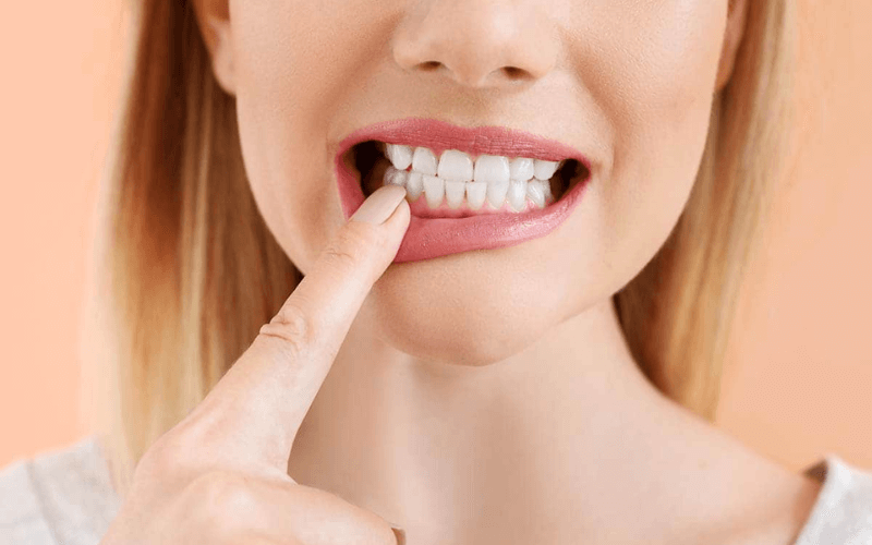 Răng vĩnh viễn bị lung lay thì phải làm sao? Cách xử lý an toàn Tuỳ vào mức độ, nguyên nhân mà sẽ có cách xử lý răng vĩnh viễn lung lay khác nhau