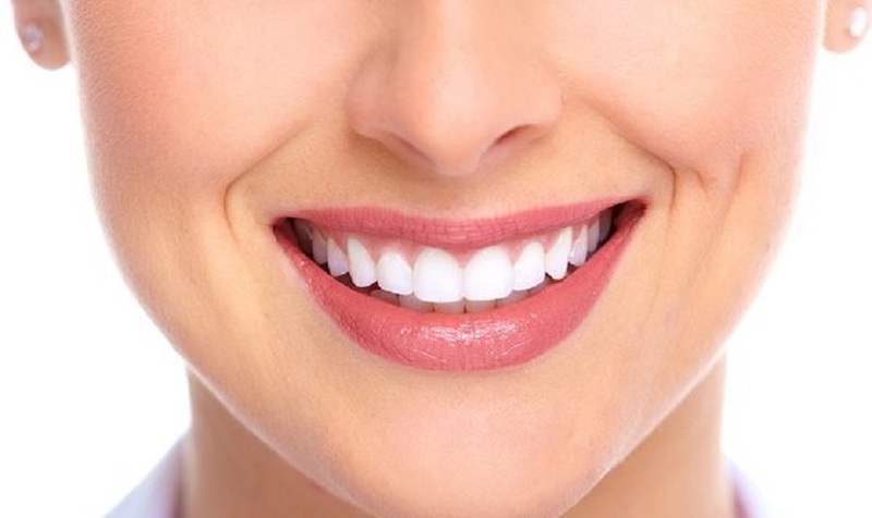 Trồng răng sứ hiện là phương pháp thẩm mỹ được áp dụng nhiều trong nha khoa