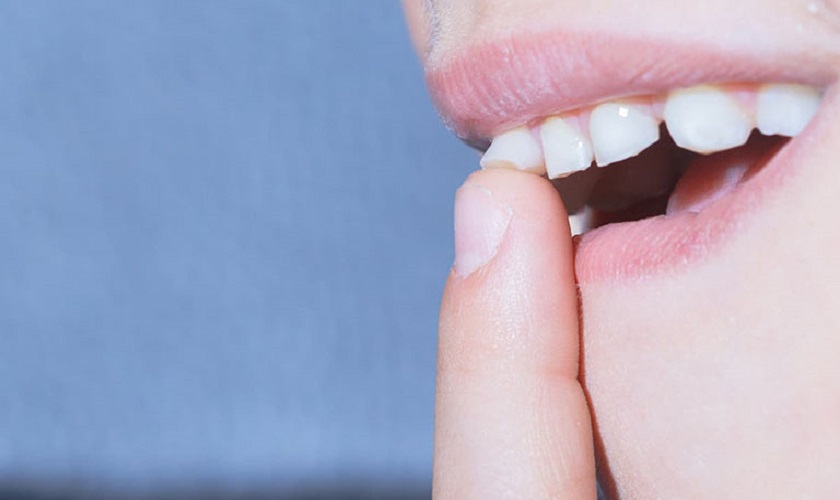 Răng cửa lung lay phải làm sao? Phương pháp xử lý hiệu quả Răng cửa lung lay báo hiệu nhiều vấn đề tiềm ẩn về sức khỏe