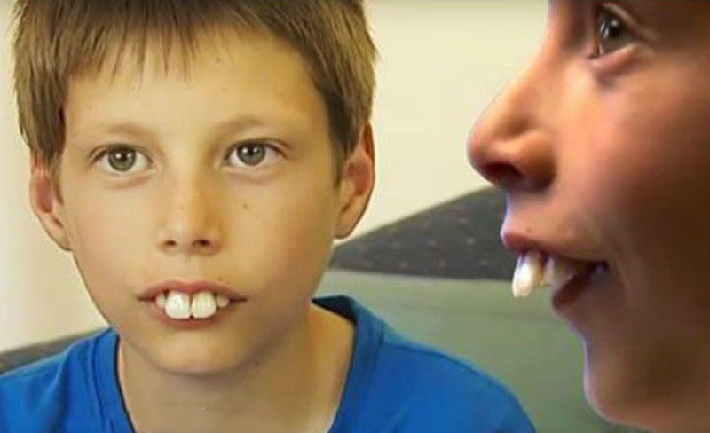 Răng thỏ bị hô sẽ mọc chìa ra ngoài làm ảnh hưởng đến thẩm mỹ 