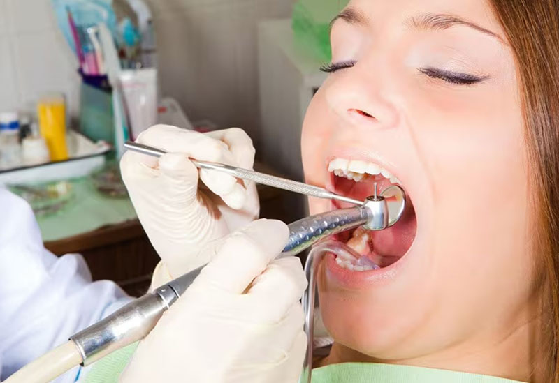 Lợi sưng phồng kèm theo nhiễm trùng nặng cần thực hiện chích rạch áp xe để giảm đau nhức 