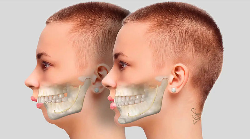Đàn ông bị hô kèm theo những mũi hếch, mắt một mí chỉ quan tâm đến lợi ích bản thân