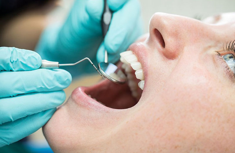 Thủ thuật loại bỏ phần viêm nhiễm vừa giúp tái tạo mô vừa ngăn ngừa lây lan sang răng xung quanh