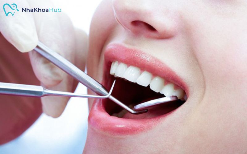 Hạn chế ăn quá nhiều đồ ngọt để bảo vệ lớp men răng