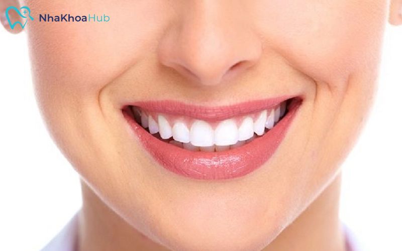 Sử dụng dụng cụ bảo vệ miệng khi tham gia hoạt động thể thao để tránh chấn thương răng