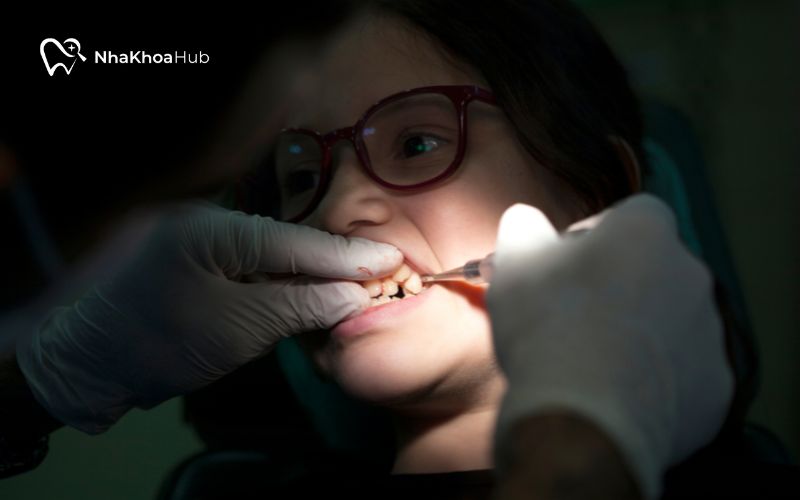 Bệnh nhân phải xác định rõ tình trạng răng miệng trước khi tiến hành nhổ răng