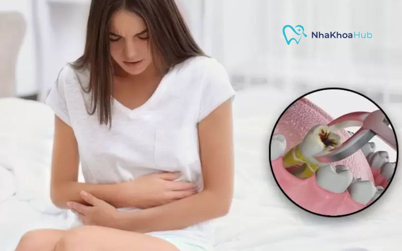 Khi đến tháng không nên nhổ răng vì dẫn đến hiện tượng máu khó đông