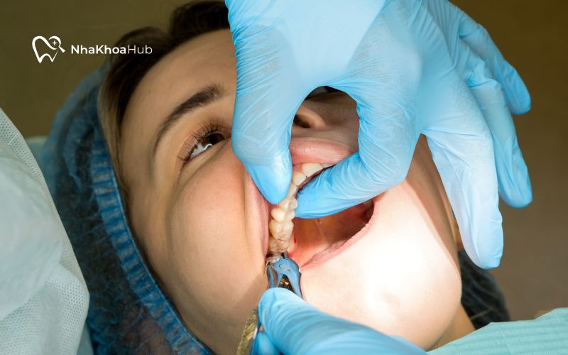 Nhổ răng vào buổi chiều sẽ cho phép bạn có thời gian nghỉ ngơi và theo dõi