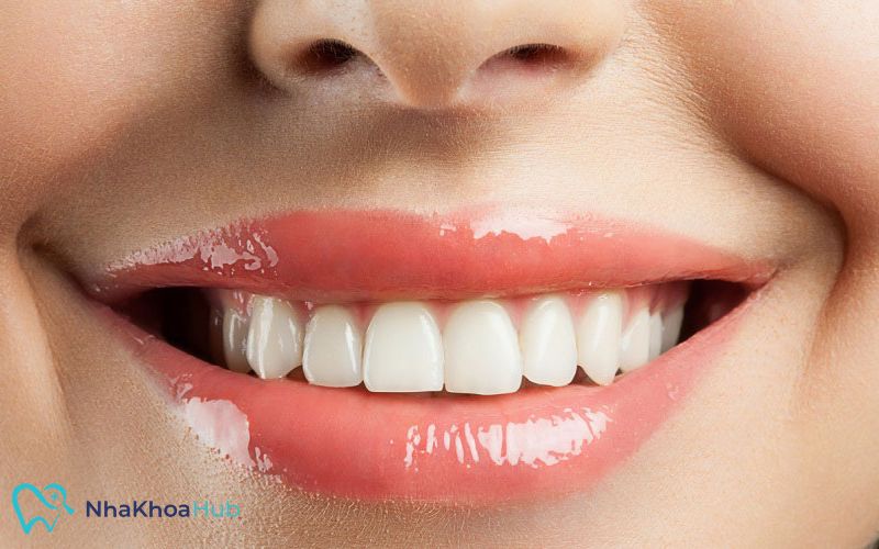 Cần có biện pháp giúp ngăn ngừa các vấn đề sâu răng để duy trì vẻ đẹp của răng 