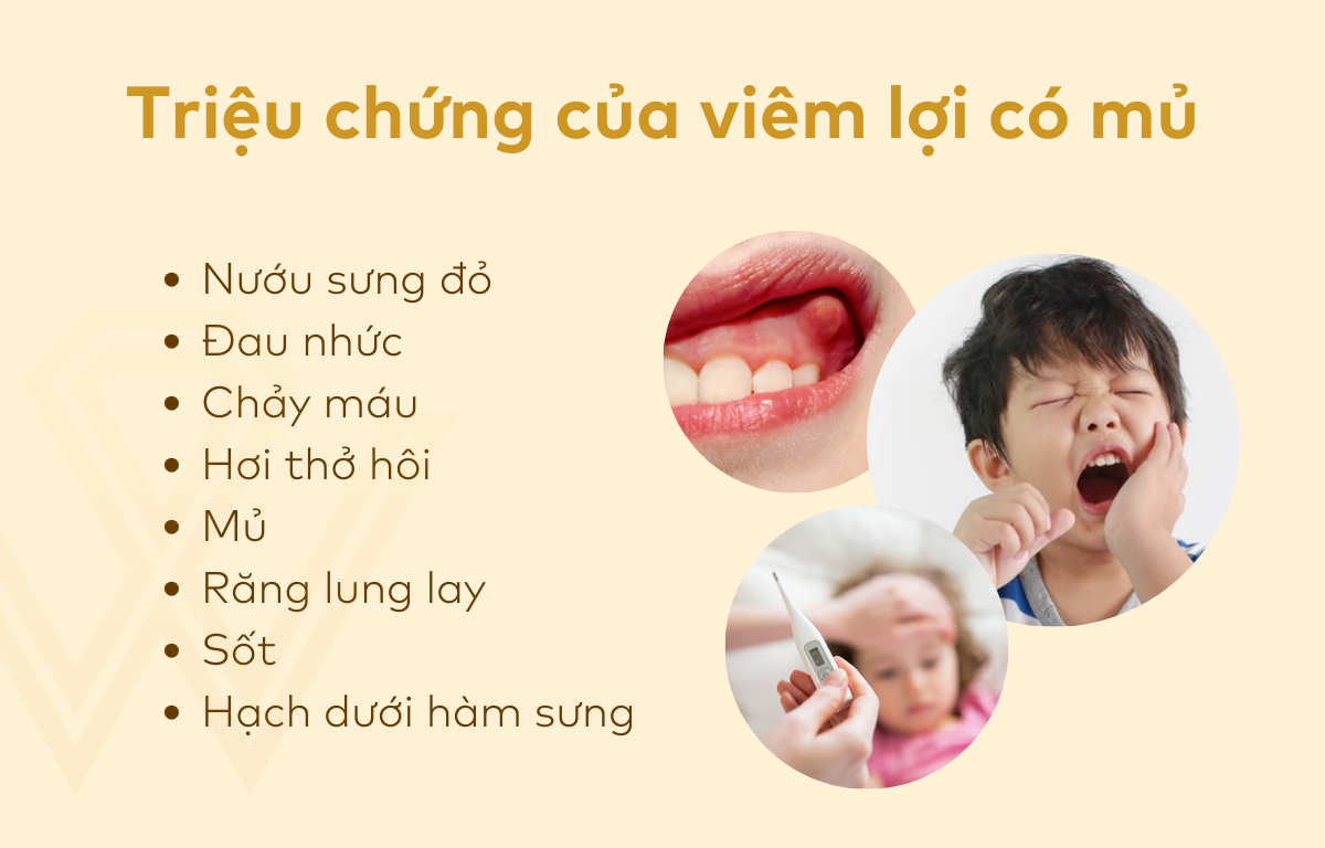 Tiết lộ các cách trị sưng nướu răng có mủ tại nhà hiệu quả Đây là một bệnh lý nguy hiểm, ảnh hưởng tiêu cực đến sức khỏe toàn diện