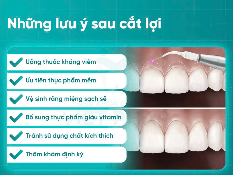 Cắt nướu có đau không? Các phương pháp phẫu thuật cắt nướu Để quá trình hồi phục diễn ra nhanh chóng bác sĩ khuyến khích nên áp dụng các lưu ý