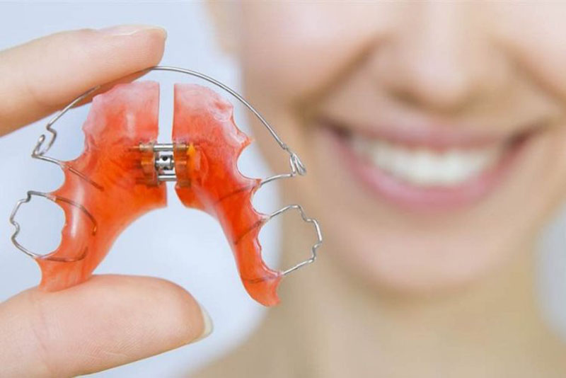 Khí cụ tháo lắp bằng dây kim loại rất phổ biến