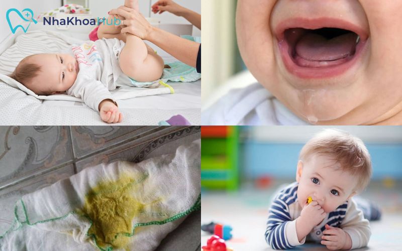 Dấu hiệu đi tướt mọc răng của trẻ và cách xử lý cho ba mẹ Hình ảnh minh họa dễ dàng nhận diện trẻ trong quá trình chuẩn bị mọc răng