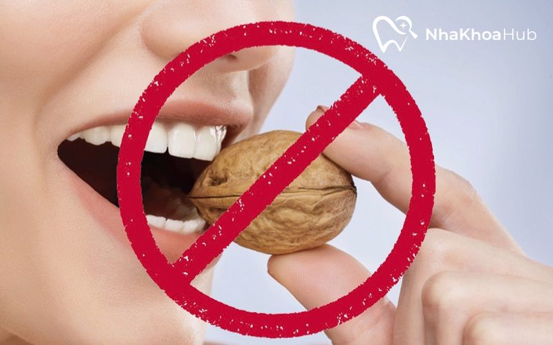 Tư vấn: Nên đính đá răng ở đâu đảm bảo độ bền và uy tín? Không ăn thực phẩm quá cứng tránh làm bong viên đá