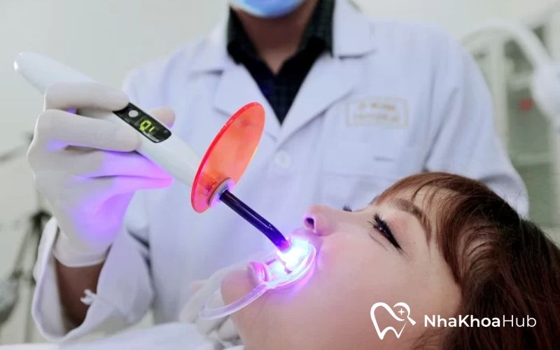Tư vấn: Nên đính đá răng ở đâu đảm bảo độ bền và uy tín? Chiếu laser làm cho keo nhanh khô và tăng độ bền cho viên đá