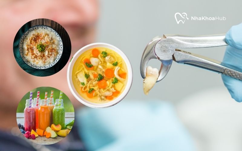 Chọn các thực phẩm mềm như cháo, súp, … sẽ mau lành sau khi nhổ răng