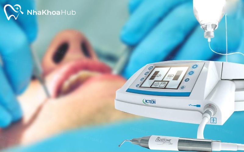 Nhổ lấy răng bằng công nghệ Piezotome có giá cao hơn so với phương pháp truyền thống