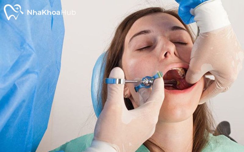 Người bệnh sẽ được tiêm thuốc tê để giảm cảm thấy đau trong lúc nhổ lấy răng