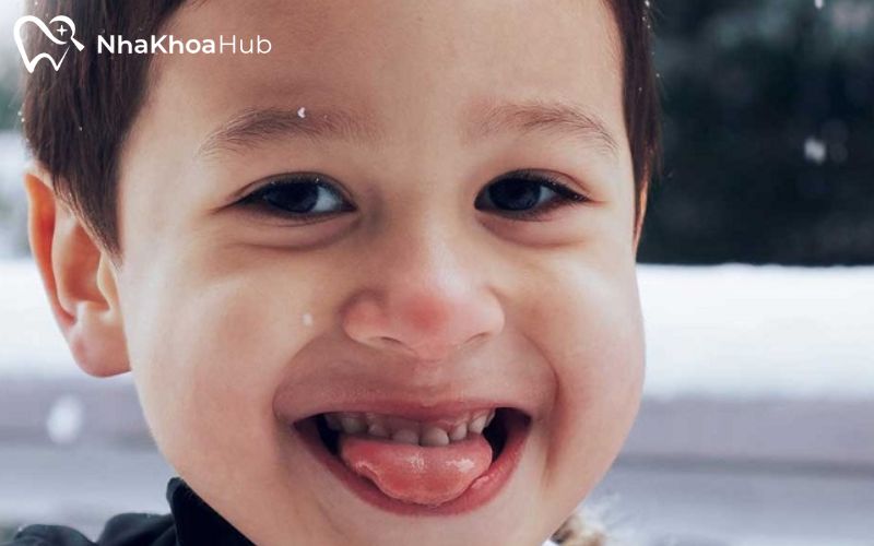 Ảnh hưởng của nhổ răng lồi xỉ và phương pháp xử lý an toàn Hạn chế thói quen xấu như mút tay, đẩy lưỡi giúp ngăn ngừa răng mọc lệch