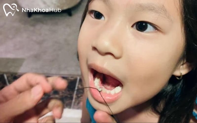 Kéo sợi chỉ một cách dứt khoát để răng rụng ra mà không gây tổn thương nướu