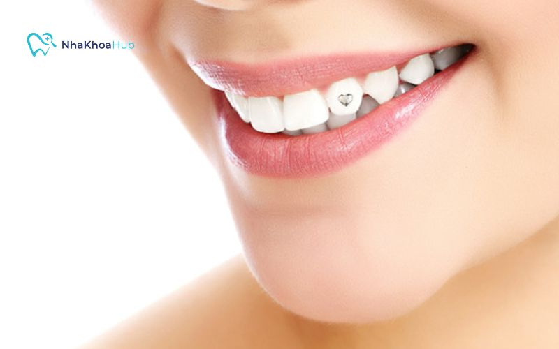 Răng đính đá bao nhiêu tiền? Bảng giá chi tiết mới nhất Khách hàng kiểm tra tình trạng sức khỏe răng miệng khi đính đá để đạt được kết quả tốt nhất
