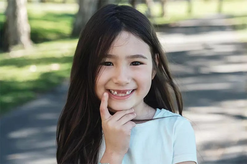 Trẻ mất răng sữa quá sớm làm gián đoạn quá trình phát triển và có thể khiến các răng mọc lệch, kẹt hoặc xoay