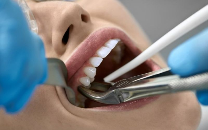 Tác hại của việc không nhổ răng sâu và cách xử lý an toàn Cảm giác đau đớn do nhiễm trùng ảnh hưởng đến tâm trạng người bệnh
