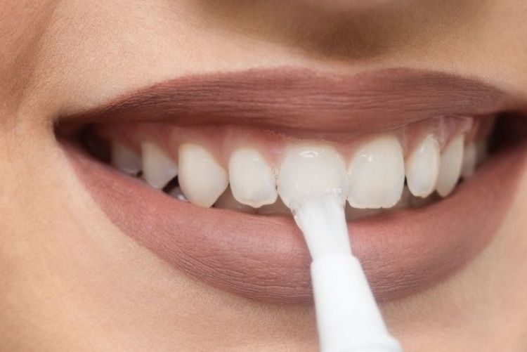 Review 7 loại bút tẩy trắng răng phổ biến nhất hiện nay Gel làm trắng thường tích hợp hydrogen peroxide hoặc carbamide peroxide