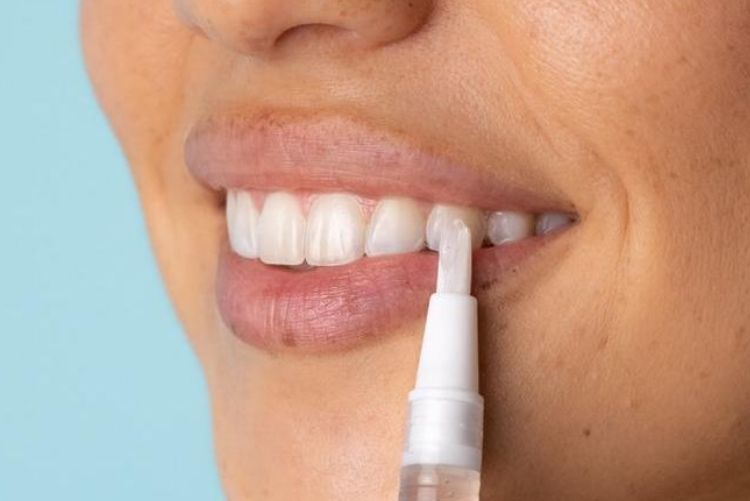 Review 7 loại bút tẩy trắng răng phổ biến nhất hiện nay Bút tẩy vết ố răng có thiết kế nhỏ gọn và dễ dùng