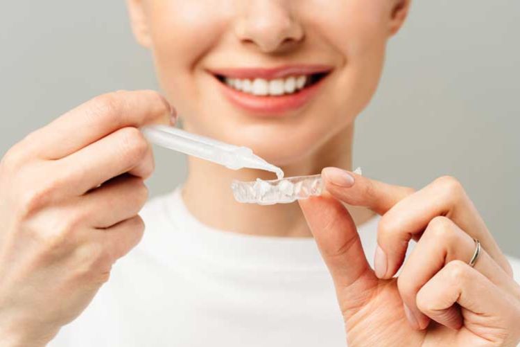 Gel tẩy vết ố răng khắc phục tình trạng răng xỉn màu, ố vàng