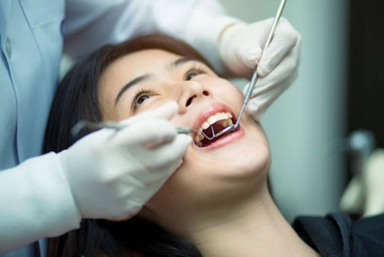 Cạo cao răng định kỳ 6 tháng/lần để loại bỏ mảng bám