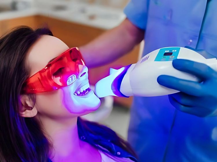 Tẩy trắng răng bằng laser là lựa chọn an toàn, hiệu quả