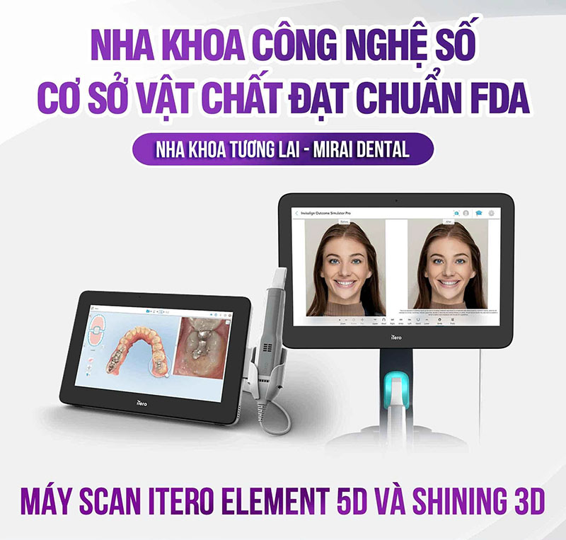 Nha khoa Tương Lai Mirai: Nụ cười đẹp thay đổi cuộc sống Công nghệ scan 3D cho hình ảnh 3 chiều chính xác đến từng micromet của toàn bộ cấu trúc răng và hàm