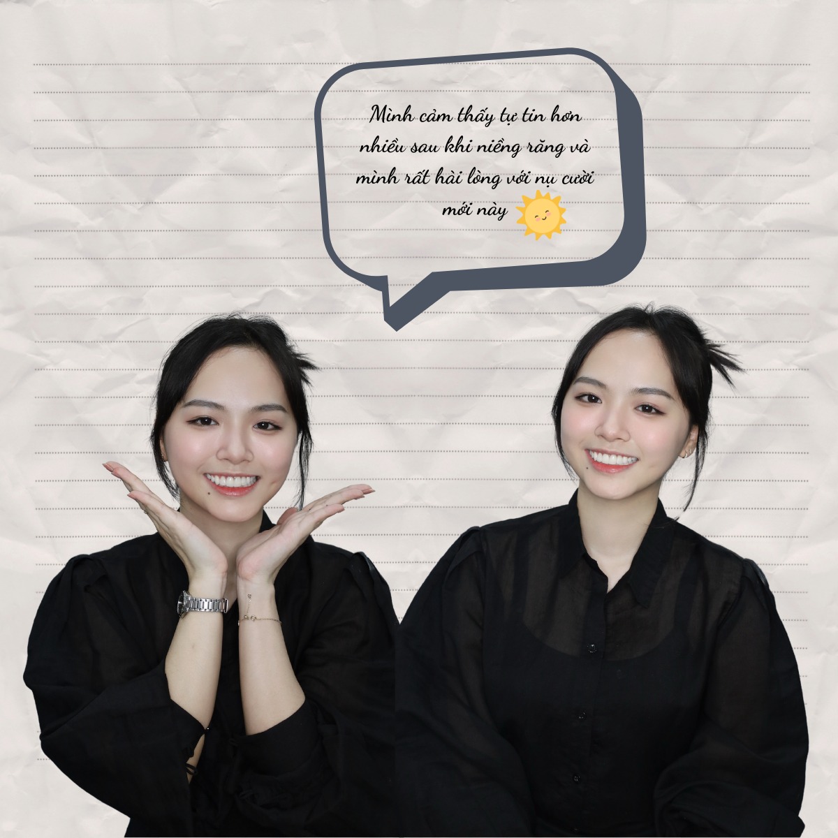 Nha khoa Quốc An – Phòng khám uy tín, đặt lịch khám nhanh Sự thay đổi này không chỉ đến từ diện mạo bên ngoài mà còn giúp Thu thoải mái hơn trong giao tiếp, chụp ảnh và trong cả công việc hằng ngày