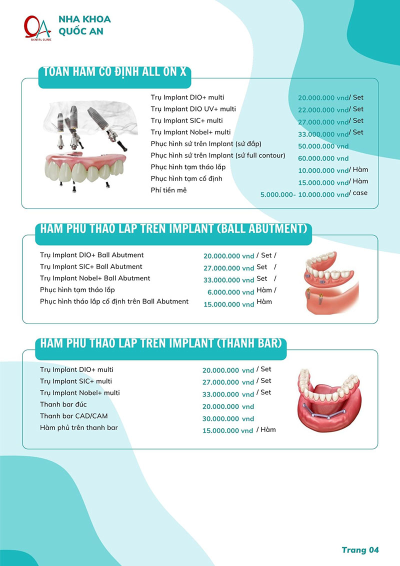 Nha khoa Quốc An – Phòng khám uy tín, đặt lịch khám nhanh Bảng giá dịch vụ của Quốc An