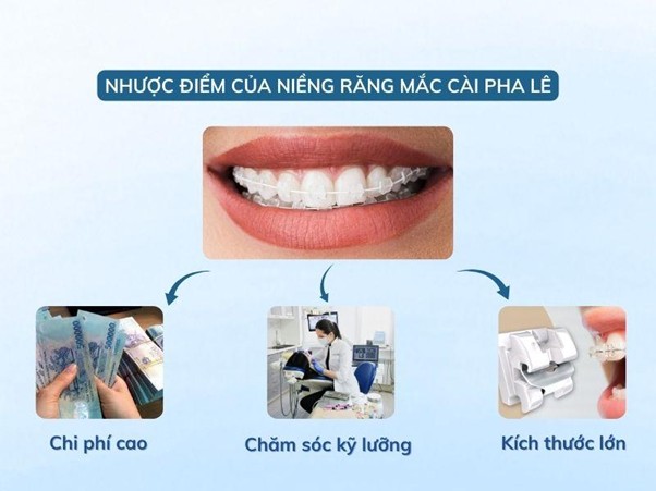 Bật mí ưu nhược điểm và chi phí niềng răng mắc cài pha lê Niềng răng mắc cài pha lê có chi phí cao hơn, cần chăm sóc kỹ và có thể gây khó chịu nhẹ do thiết kế dày hơn
