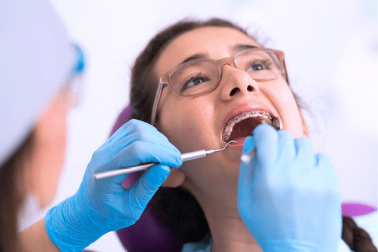 Niềng răng nhanh nhất mất bao lâu? Cách rút ngắn thời gian Niềng răng lâu không tùy thuộc vào sự phối hợp của khách hàng