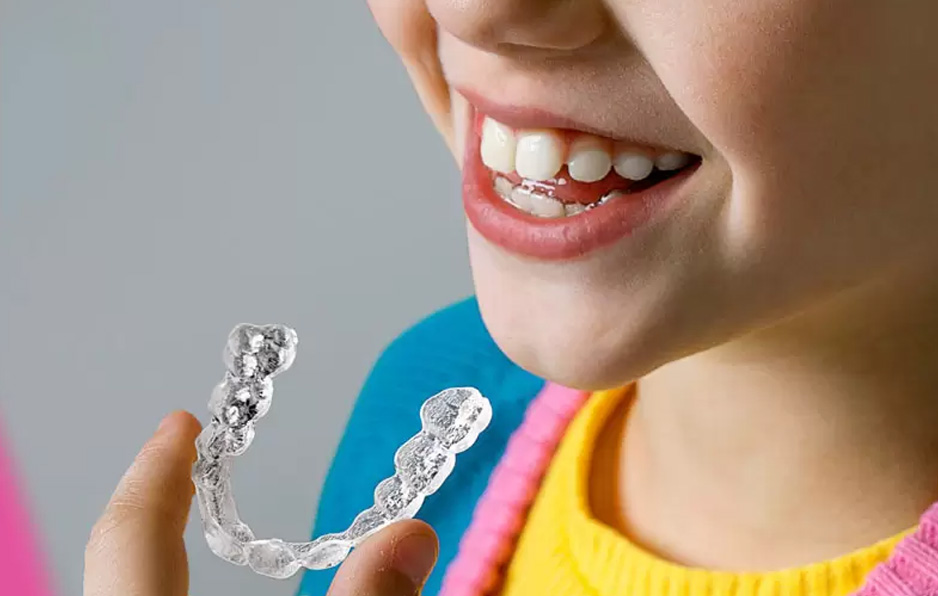 Trẻ cần đeo khay niềng ít nhất 20 - 22 giờ mỗi ngày để đạt hiệu quả cao