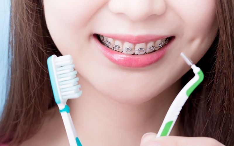 Cách chăm sóc răng Implant sau khi niềng