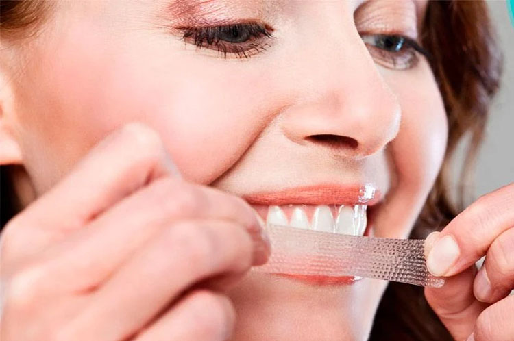 Những tác hại của tẩy trắng răng có thể bạn chưa biết Quá lạm dụng biện pháp làm trắng khiến răng yếu dần