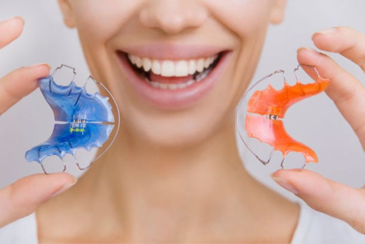 Cần đeo hàm duy trì đúng hướng dẫn sau khi kết thúc chỉnh nha