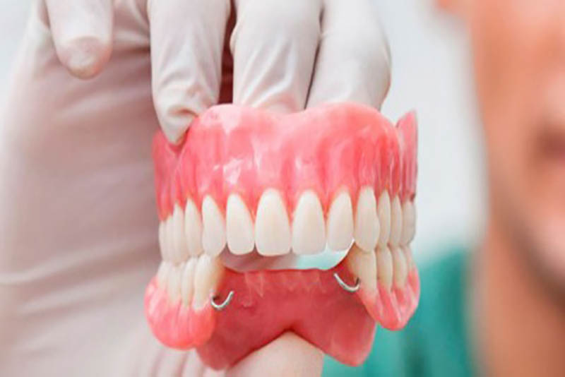 Lựa chọn đúng phương pháp và cơ sở trồng răng uy tín giúp đảm bảo an toàn và độ bền của răng giả